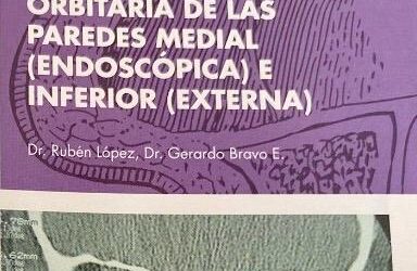 Orbitaria de las paredes Medial e Inferior