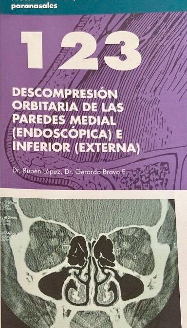 Orbitaria de las paredes Medial e Inferior